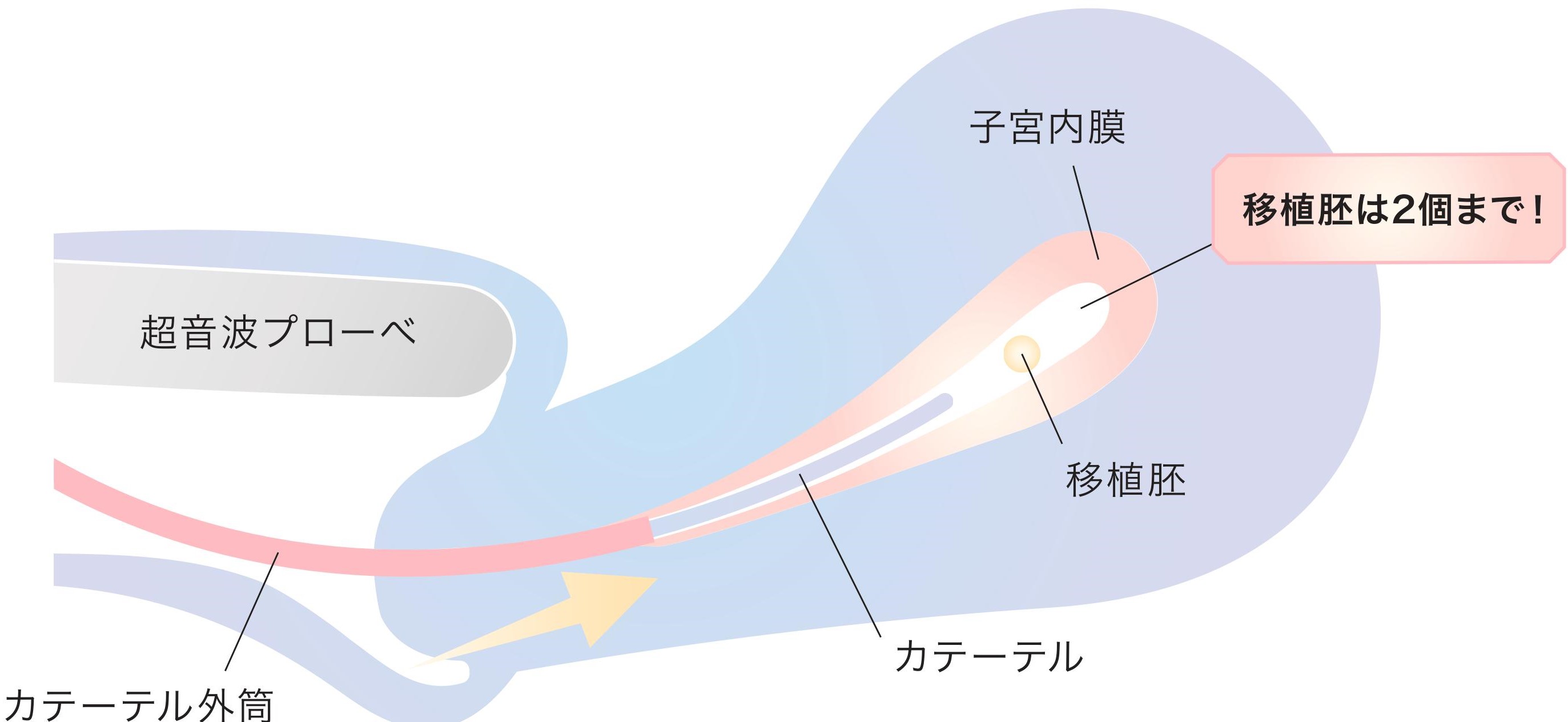 mb-1
